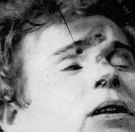 Крупный план вмятины