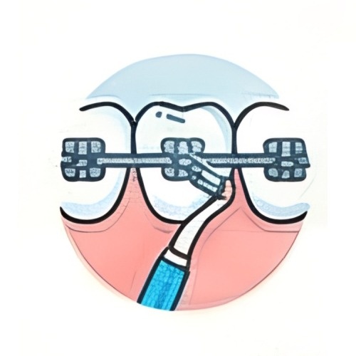 Весь период ношения брекетов важно тщательно следить за гигиеной полости рта. 