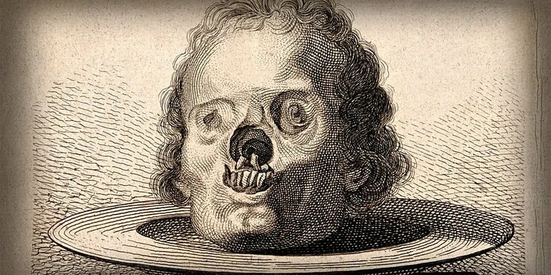 Эпидемия сифилиса-2026: миллионны заражённых по всему миру - что ждёт россиян?