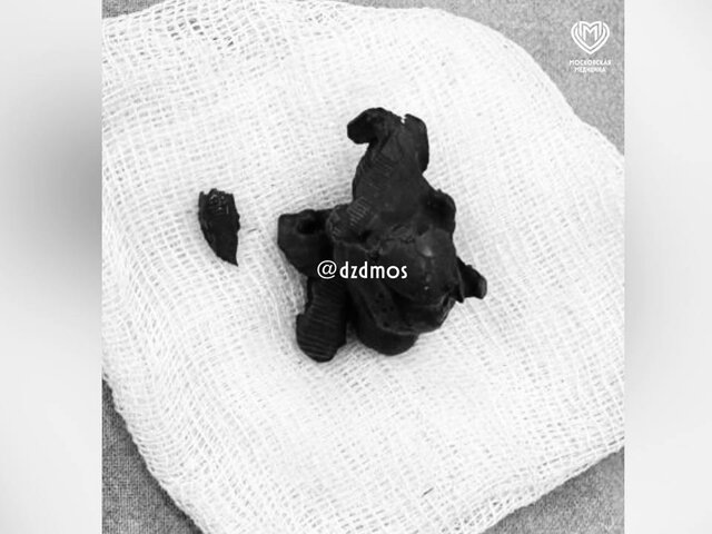    Фото: телеграм-канал "Московская медицина"