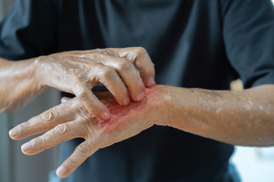    Shutterstock/FOTODOM