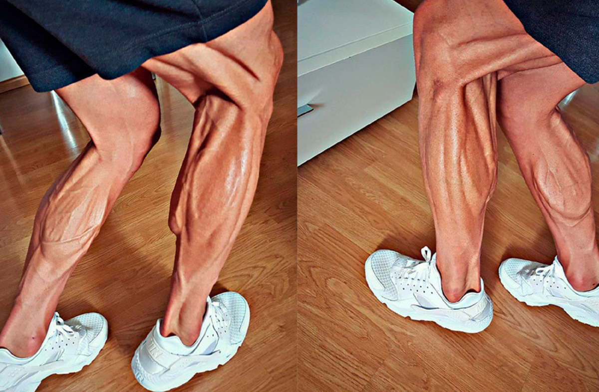 ноги Марчинского