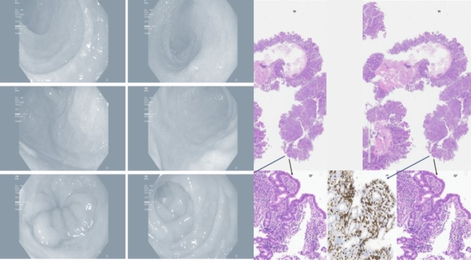   N + 1; Silvia Suardi / BMJ Case Reports, 2026