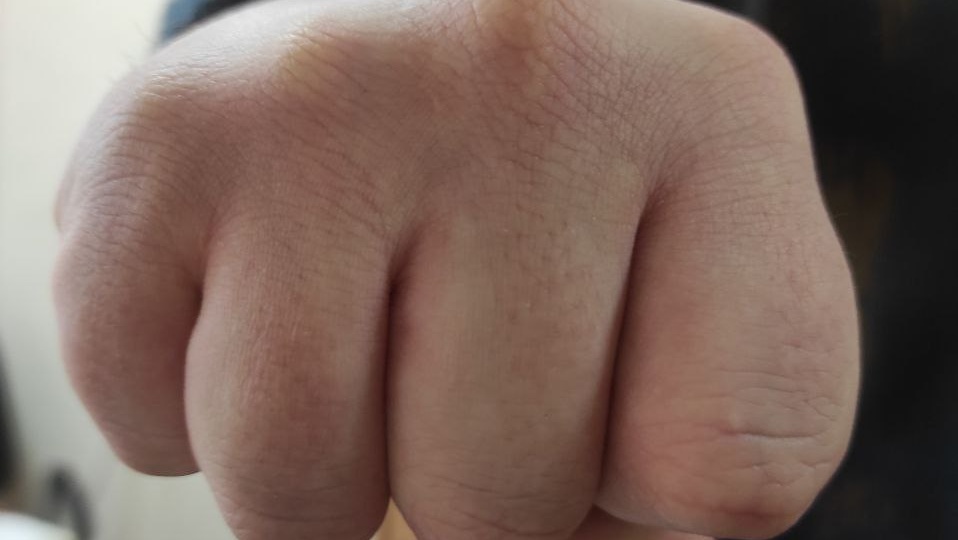 В Курской области конфликт из-за долга в 5 тысяч рублей закончился ножевым ранением