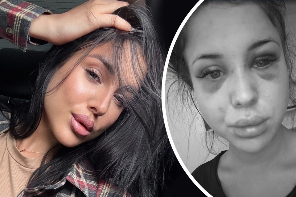    По словам Екатерины, в ночь на 2 января ее избили до перелома ребер. Фото: предоставлено героиней публикации