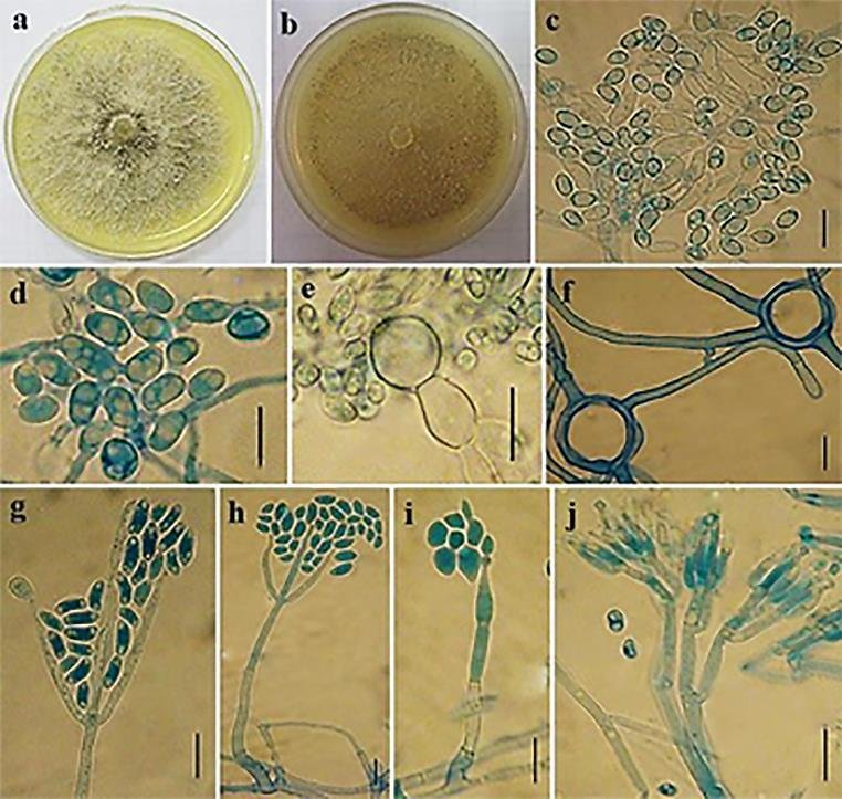 Морфологические особенности Клоностахиса Clonostachys rosea.