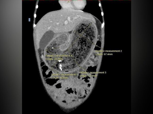    Фото: телеграм-канал "Клиника доктора Рошаля"