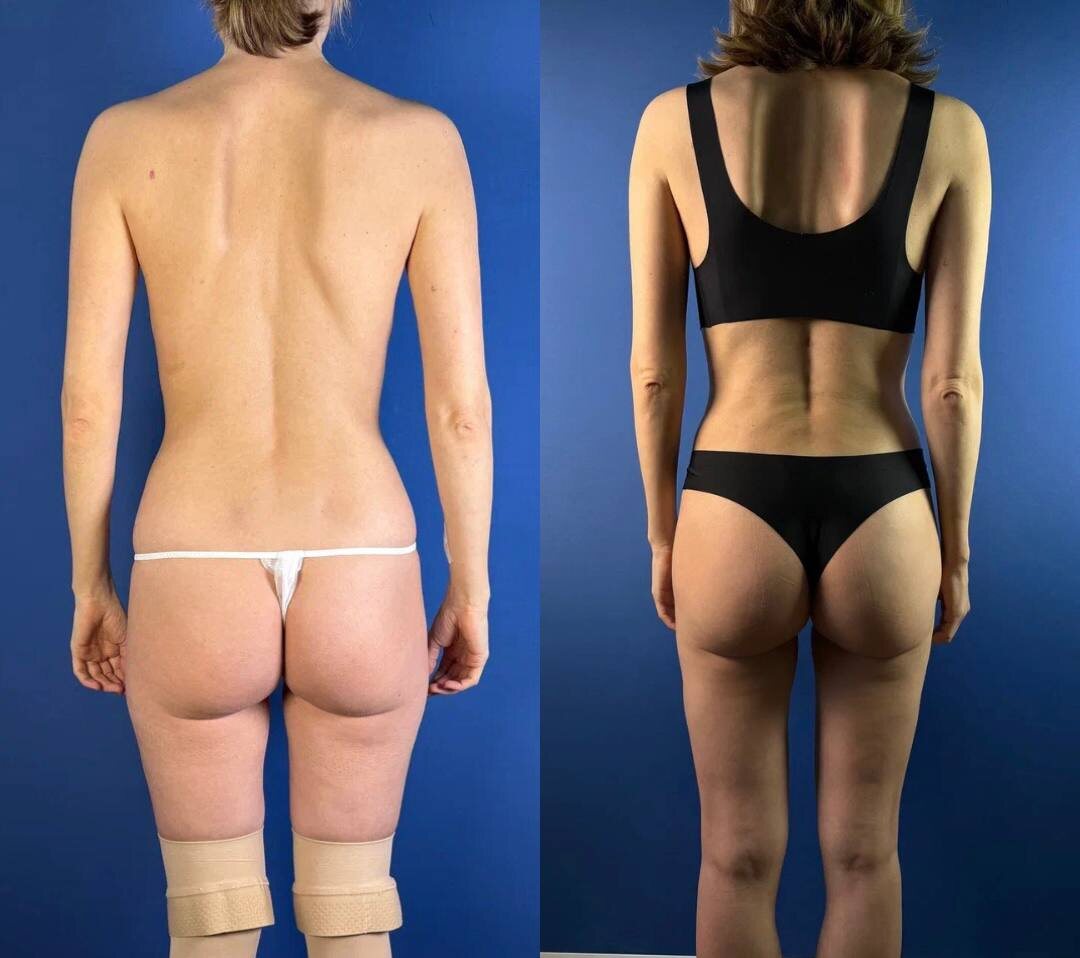 Моя пациентка до и после. 