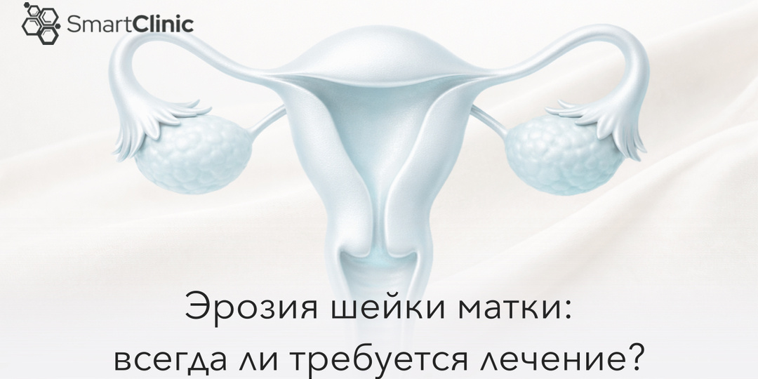 Эрозия шейки матки: всегда ли требуется лечение?