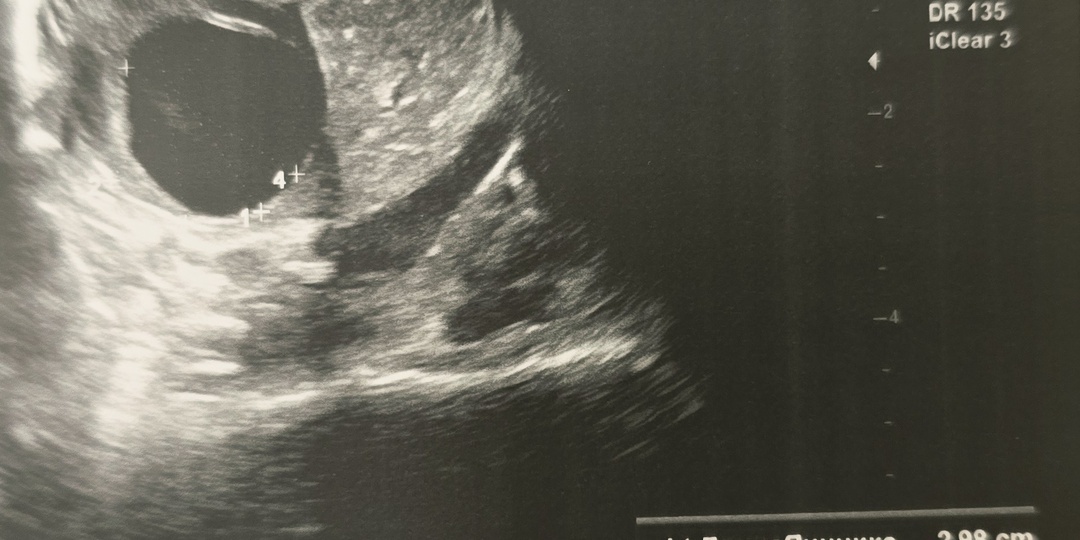 Она пришла “просто на УЗИ”. А календарь показал идеальный день для зачатия