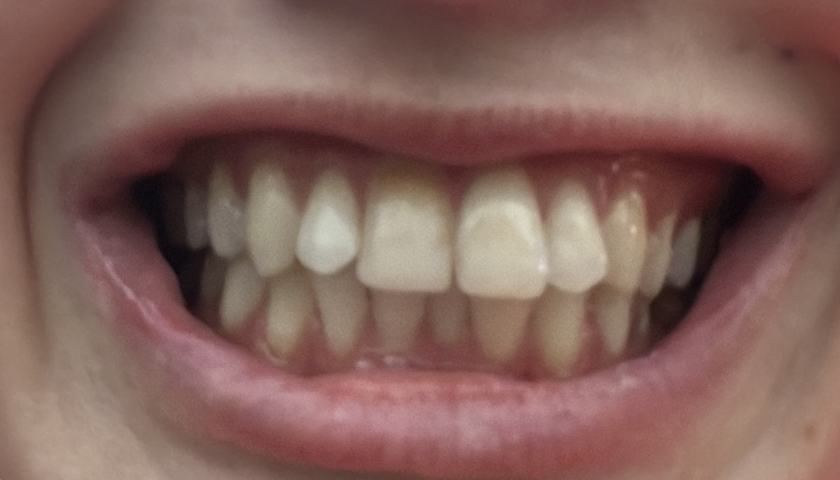 Такая я пришла, сейчас ситуация хуже 