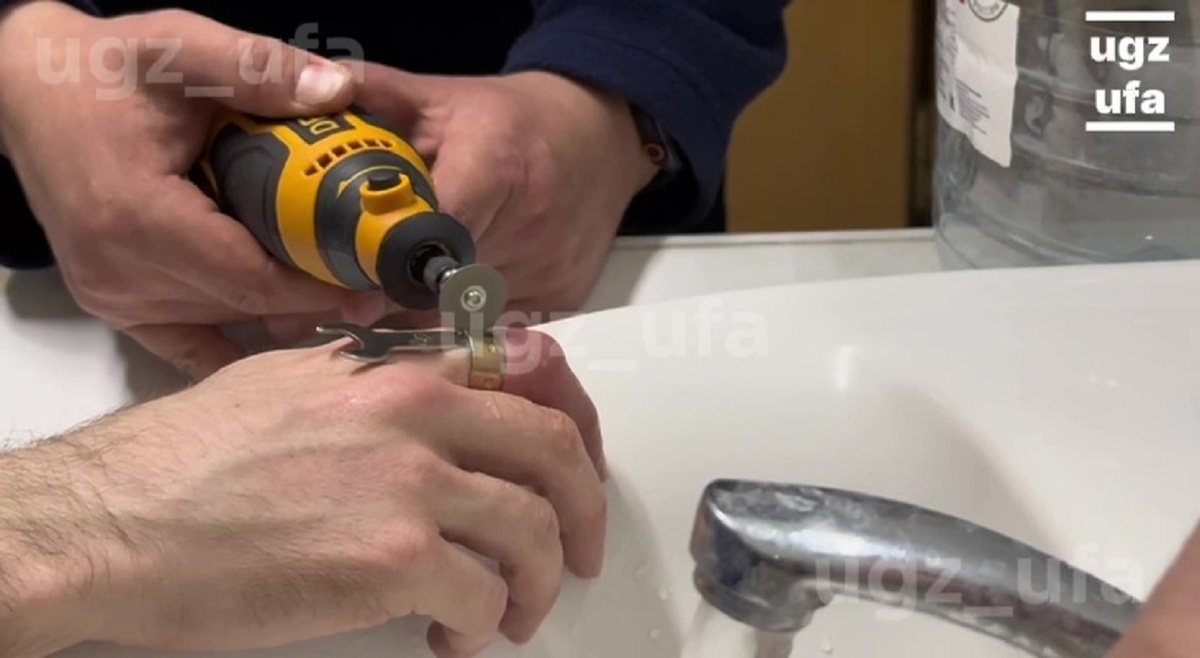    Уфимец проснулся с неприятным сюрпризом на пальце