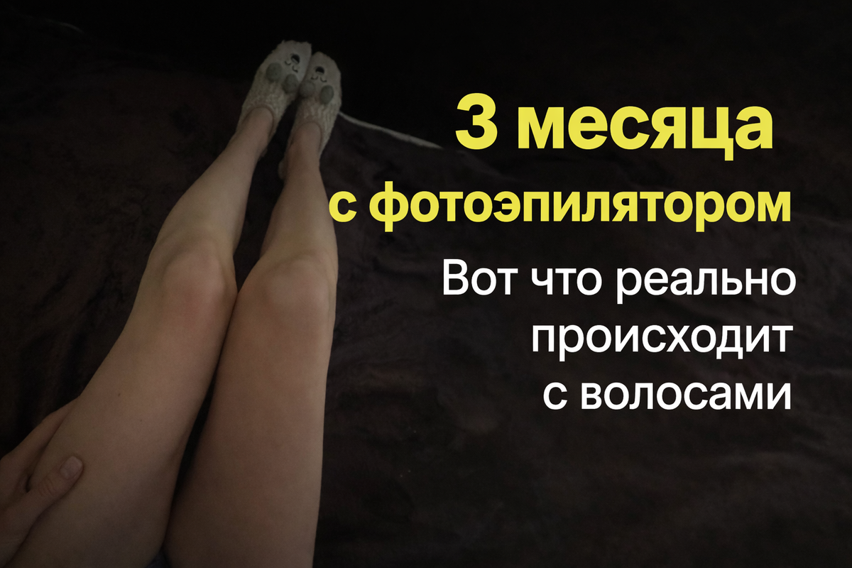 честный отзыв на фотоэпилятор