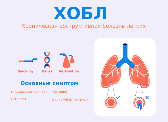 Хроническая обструктивная болезнь лёгких (ХОБЛ)