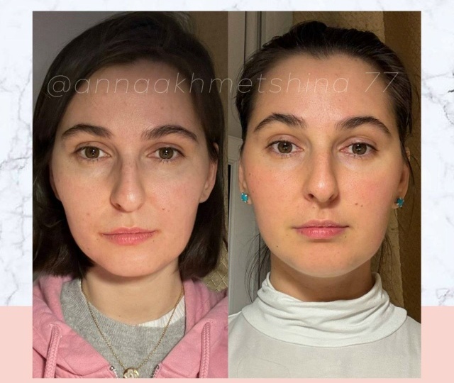 РЕЗУЛЬТАТ ВИКТОРИИ💙