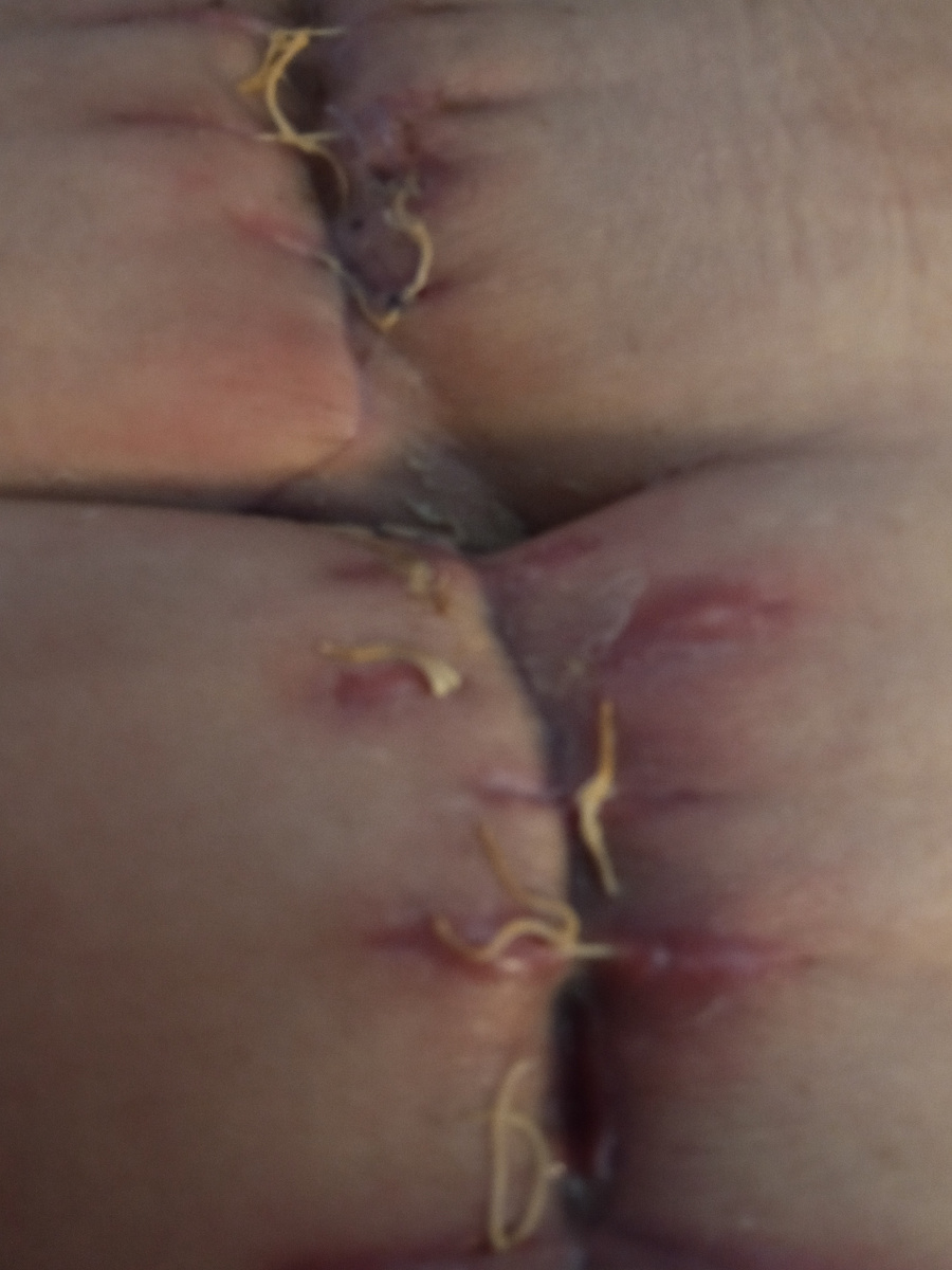 Фото автора . Любое движение доставляло боль. 