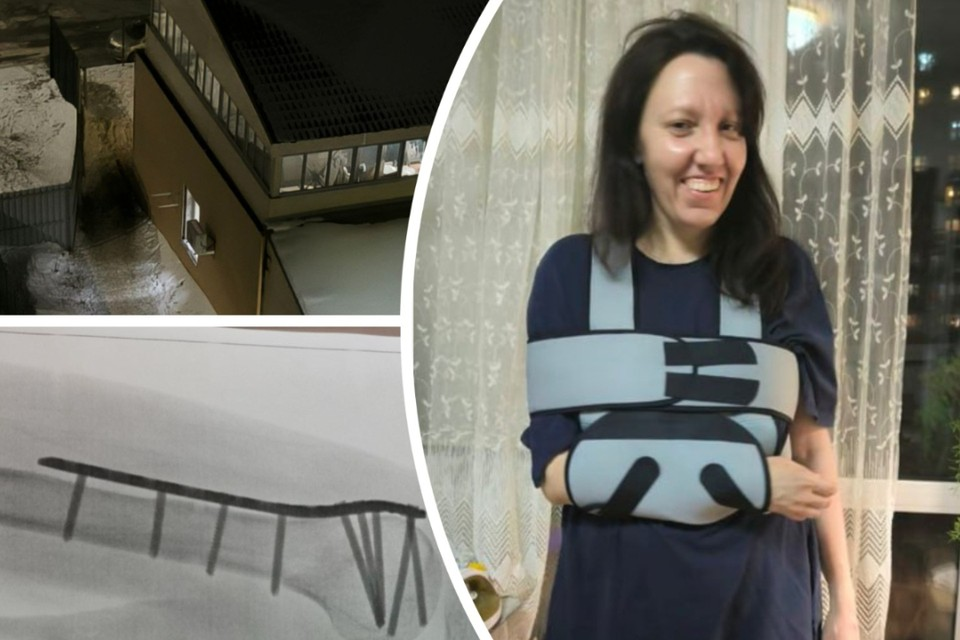 Женщина получила тяжелый перелом на гололеде у магазина. Фото: Предоставлено Натальей Яниной