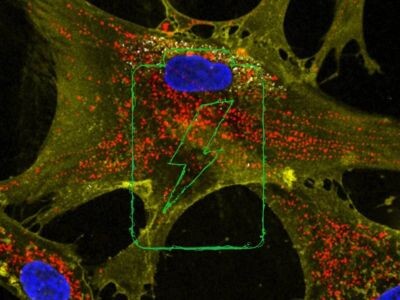    Наночастицы могут «перезаряжать» клетки и замедлять старение