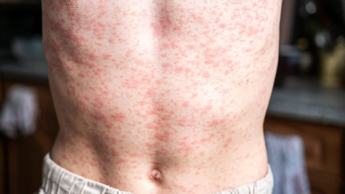   Adobe Stock- Архивное фото