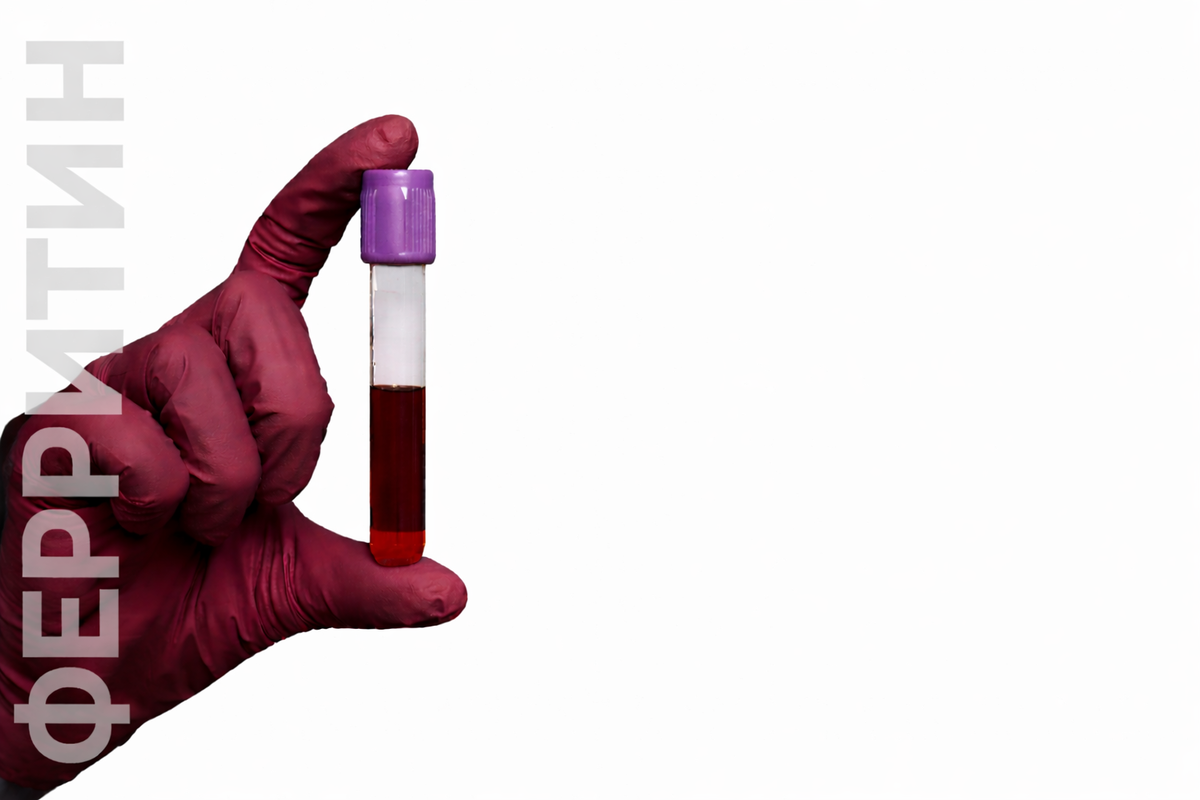 Анализы для определения дефицита железа и анемии: общий анализ крови, ферритин, ОЖСС, трансферрин, фолиевая кислота