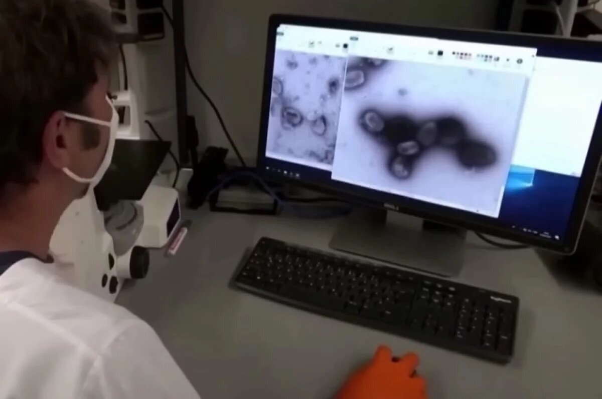    Из Домодедовской больницы выписали переболевшего оспой обезьян пациента