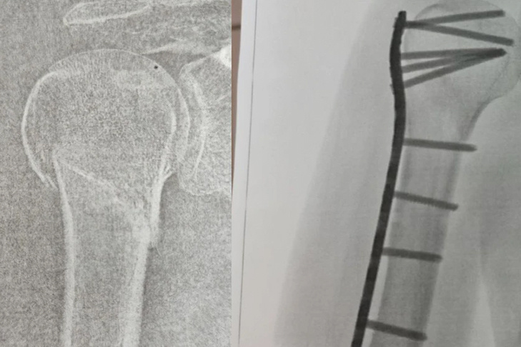    Фото КП-Новосибирск