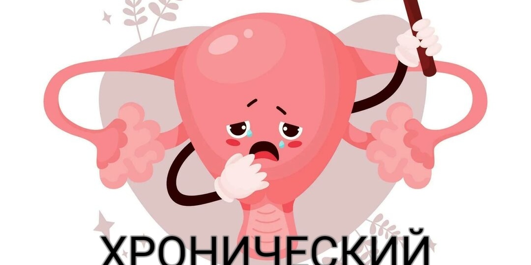 Хронический эндометрит: лечить или не лечить?