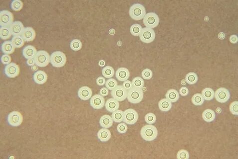 Кружочки Cryptococcus