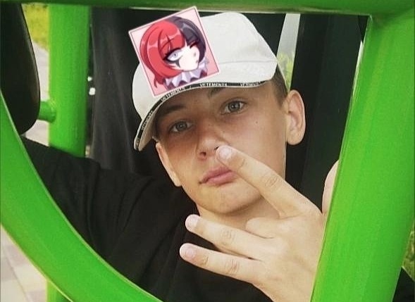 Синдром Лайелла: иммунная катастрофа 15-летнего Артема