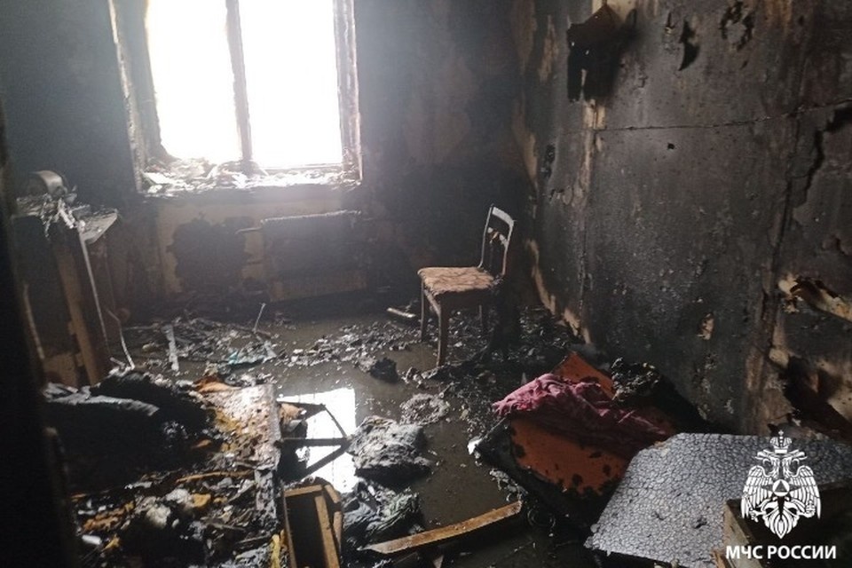    Спасенный мужчина получил ожог правой кисти. Фото: МЧС Удмуртии