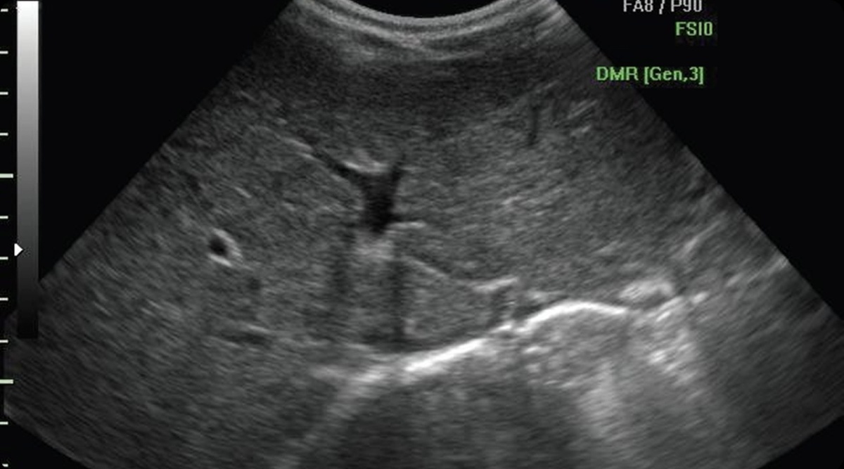 Вот так выглядит печень на УЗИ 