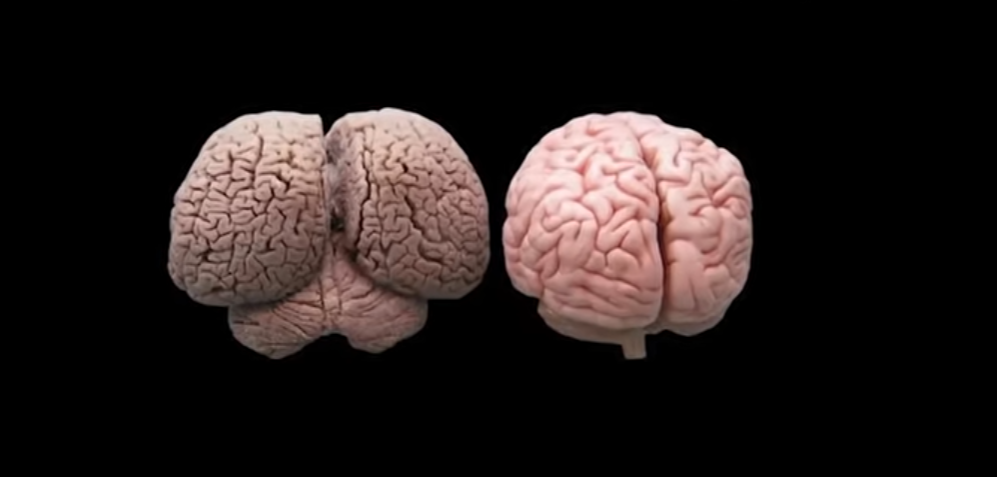 Слева - мозг дельфина; справа - человеческий.