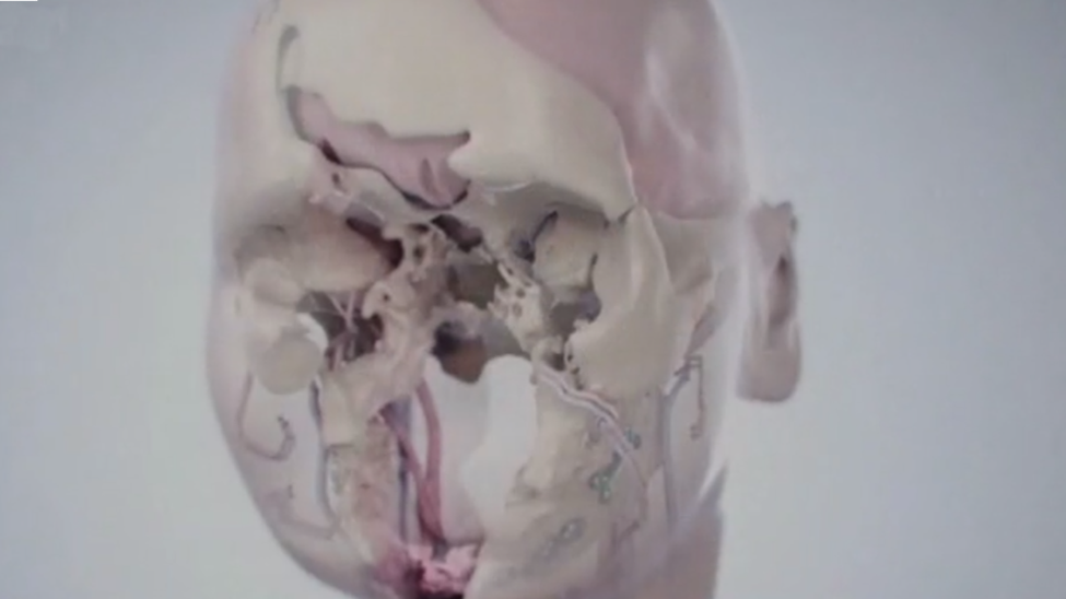 Эта графика показывает, что стало после выстрела себе в лицо, другие фото слишком графические и я не стал их тут показывать. BBC документальный фильм (с)