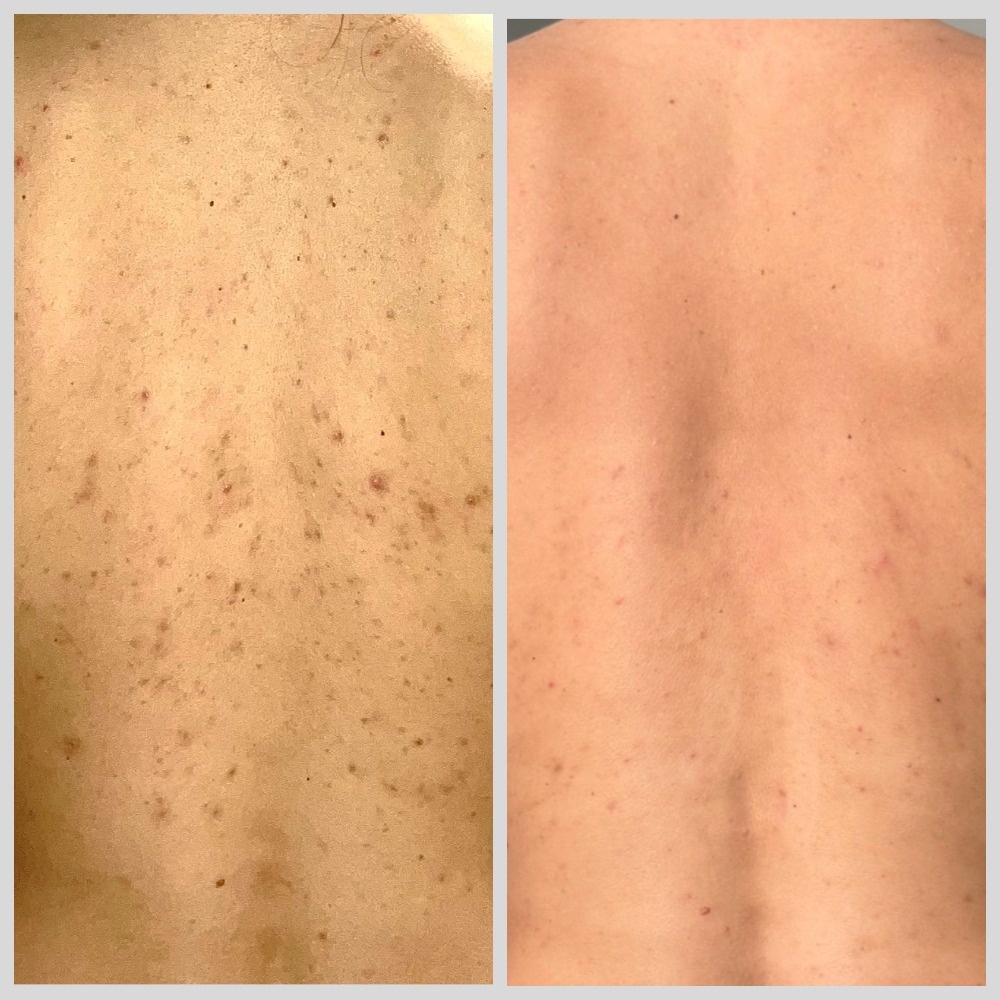 Мои реальные результаты за 3 недели