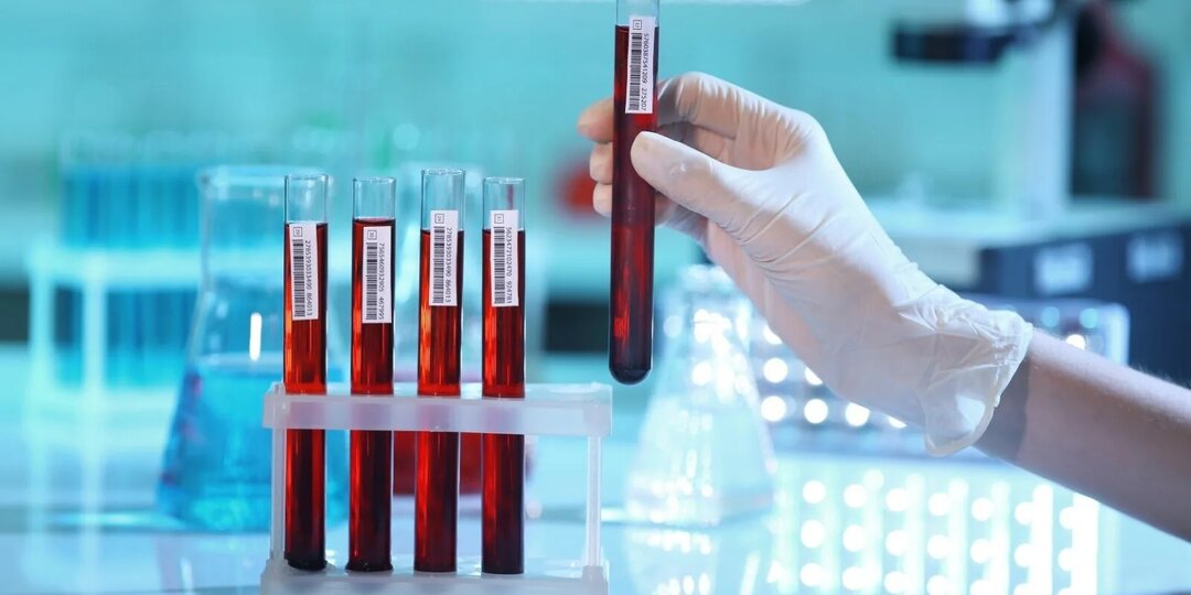 Как подготовиться к анализам и процедурам, чтобы результат был точным с первого раза