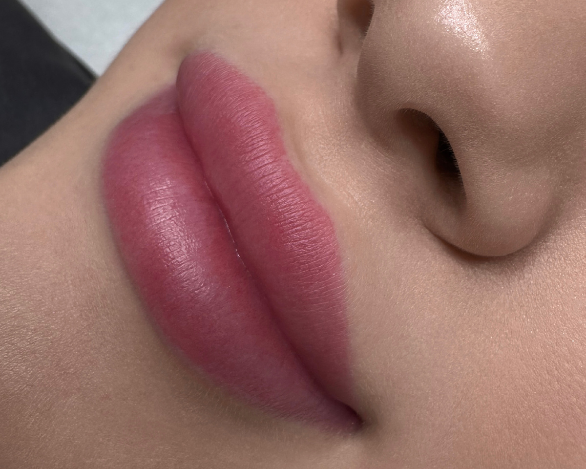 Заживший ПМ губ