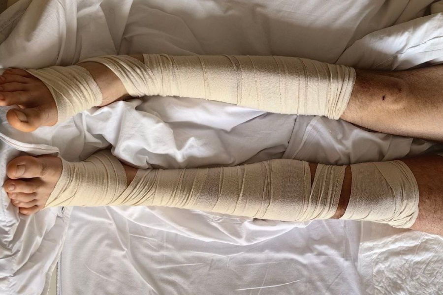 Роман в больнице после травмы
Фото: из личного архива