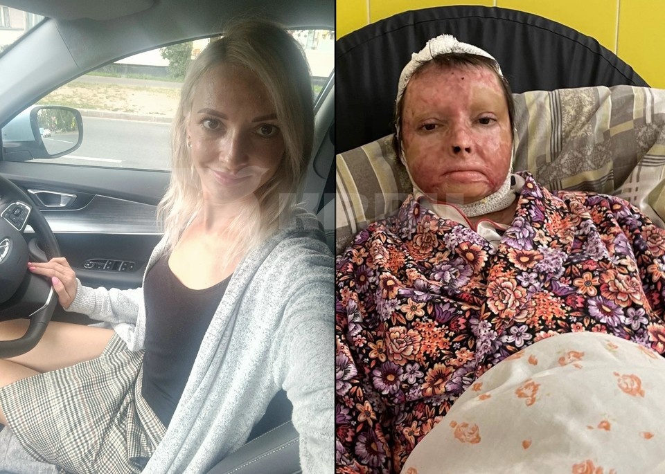    Инна до и после покушения. Фото: личная страница ВКонтакте / предоставлено "КП"