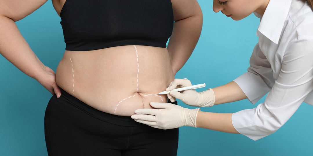 Повторные бариатрические операции увеличили риск серьезных осложнений