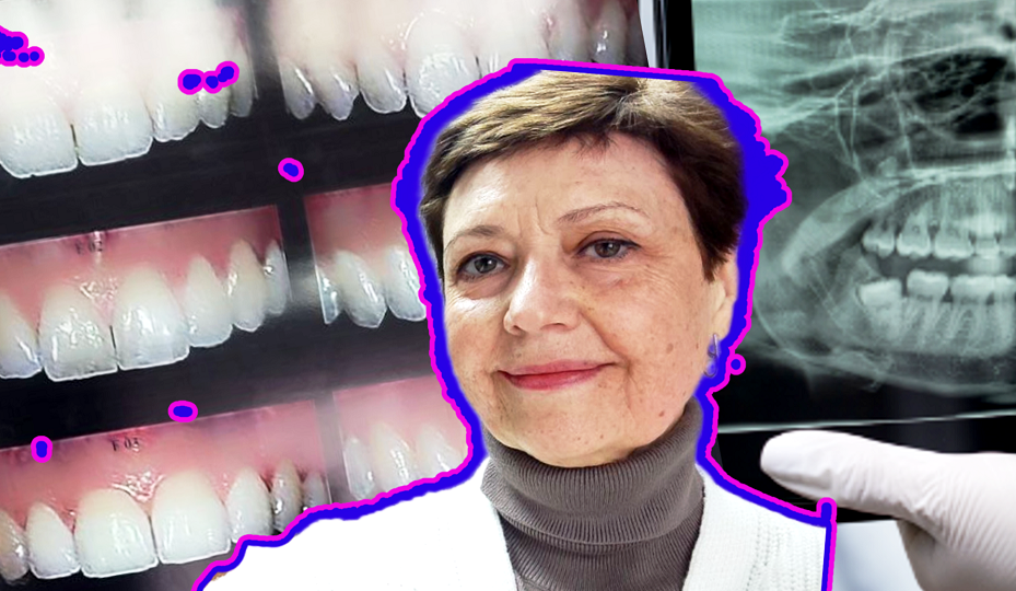 «Удар в челюсть». Как не нужно лечить зубы онкобольным – личный опыт