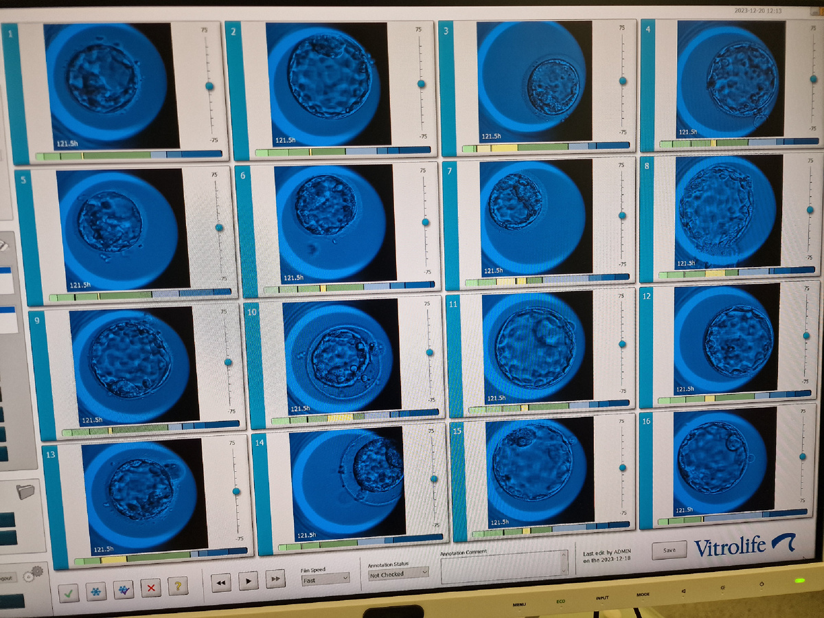 Эмбрионы в эмбриоскопе