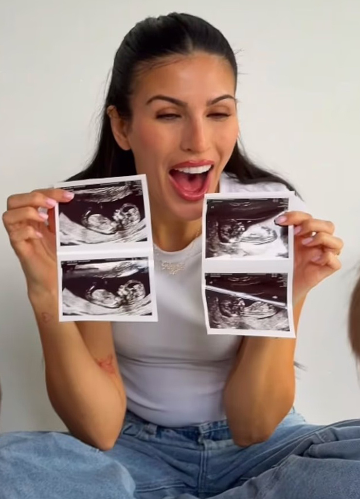    Эмили Миллер ждет двойнюСоцсети Эмили Миллер