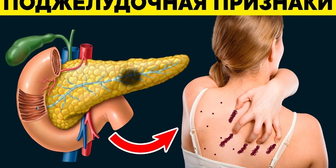 Слабость после еды — что происходит с поджелудочной