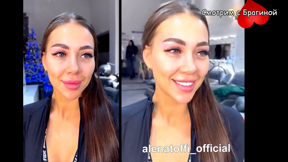 Алёна Савкина после приёма у косметолога. Фото: соцсети