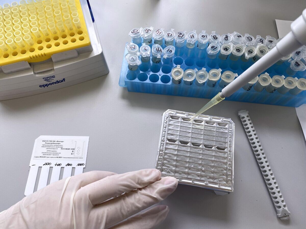    Тест-система для выявления случаев заражения оспой обезьян, созданная государственным научным центром "Вектор" | © РИА Новости / Пресс-служба научного центра вирусологии и биотехнологий "Вектор"