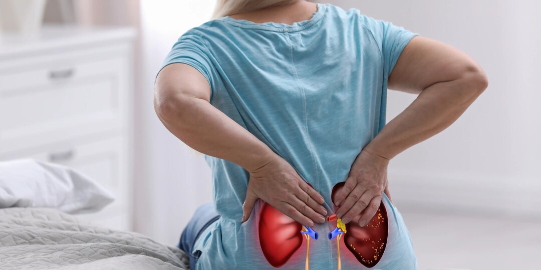 Врач пояснила как болят почки: 11 ключевых симптомов, которые нельзя перепутать с болью в спине или животе