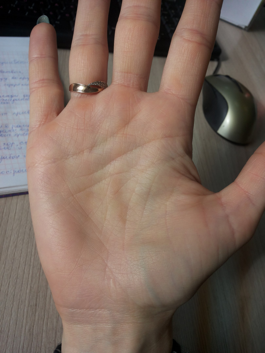 Двойная
 линия ума.Причем верхняя линия ума - с наложенным разрывом. Нижняя 
линия ума более тонкая и с сильным уклоном вниз.  
https://vk.com/hirokristall?w=wall-122866040_27943