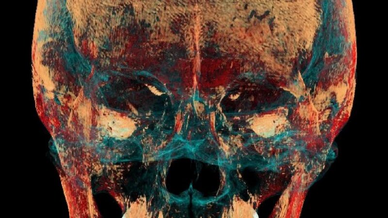     Фото черепа тела женщины возрастом 2,5 тыс. лет. Елена Панфило, пресс-служба НГУ