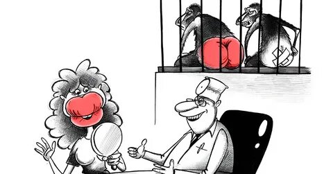 Хотела как Ким Кардашьян, а получилась карикатура: 11 карикатур, где пластика сыграла злую шутку