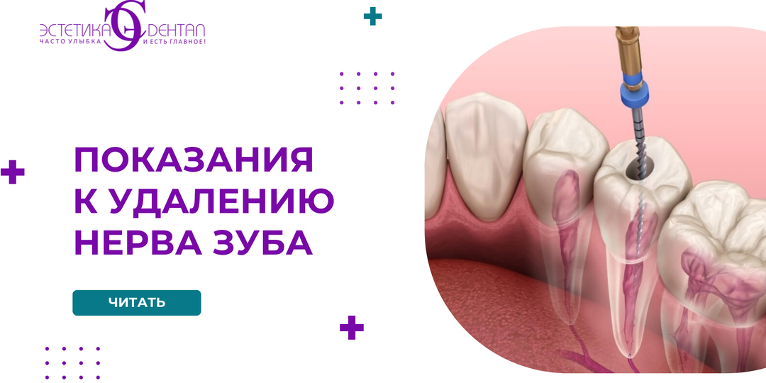 Показания к удалению нерва зуба: когда лечение действительно необходимо и как сохранить зуб